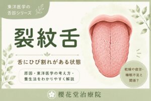 裂紋舌（れつもんぜつ）のイラスト。舌の中央や表面に複数のひび割れや溝が見られる状態で、乾燥や疲労、睡眠不足との関係を解説する東洋医学の舌診シリーズ。